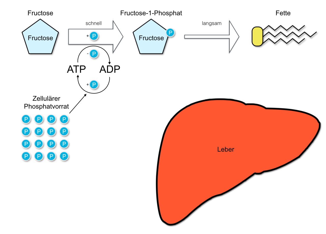 Fructose-Stoffwechsel-Gicht1