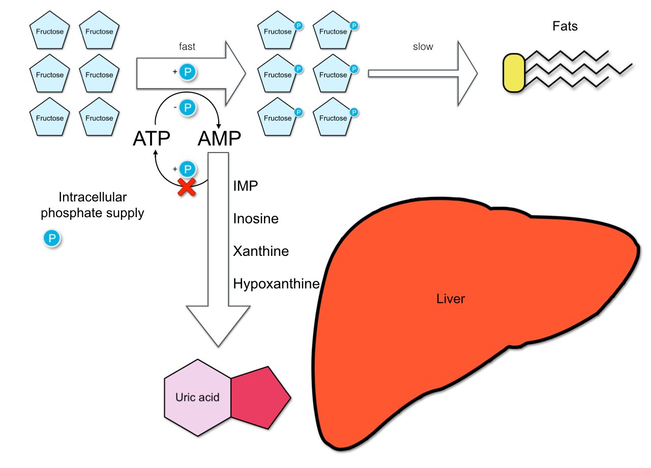 Gout-fructose-metabolism2